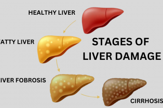 Can Fatty liver Cause Weight Gain