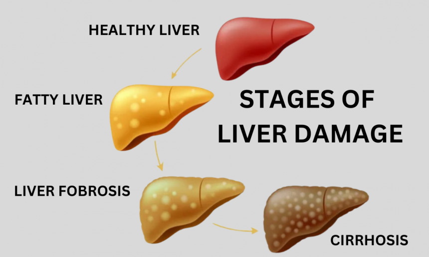 Can Fatty liver Cause Weight Gain