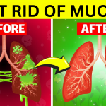 How to Remove Mucus From Lungs Naturally