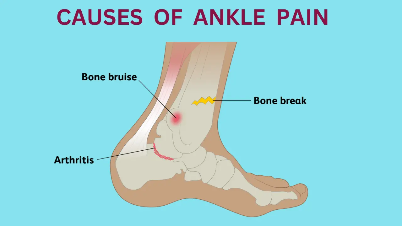 knee And Ankle Pain Same Leg