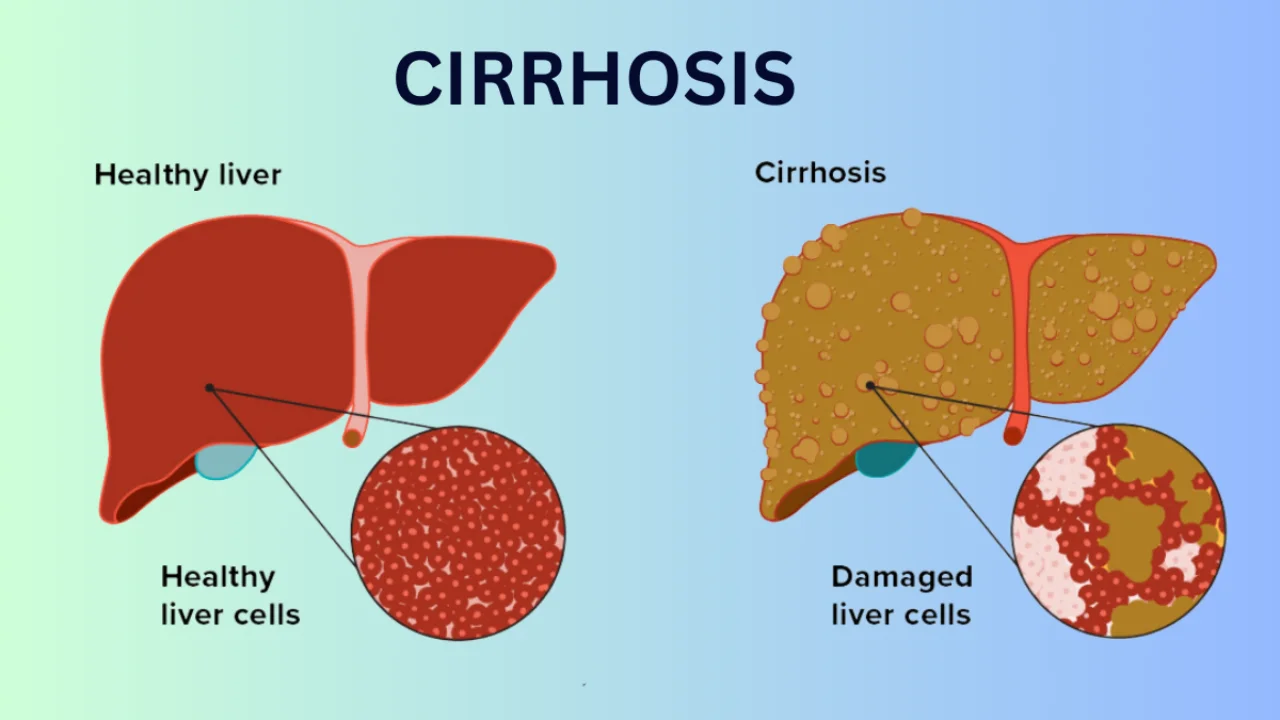 Damage Liver Symptoms