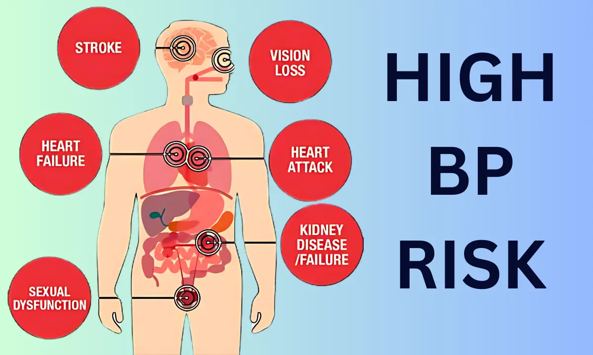 When BP High Symptoms