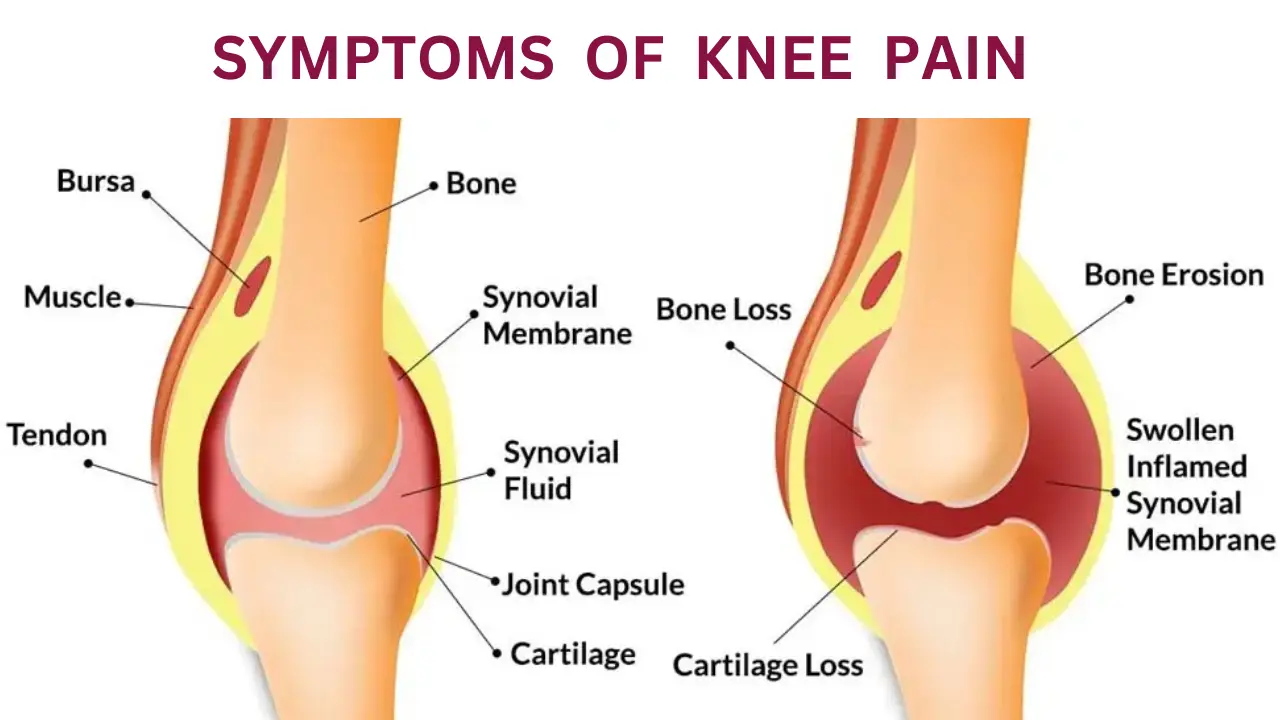 knee And Ankle Pain Same Leg