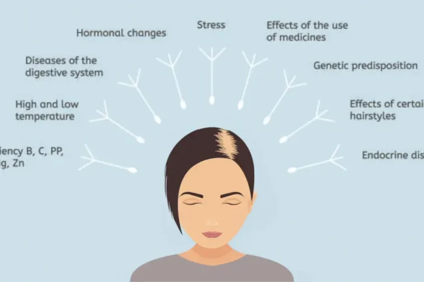 Stress Hair Loss