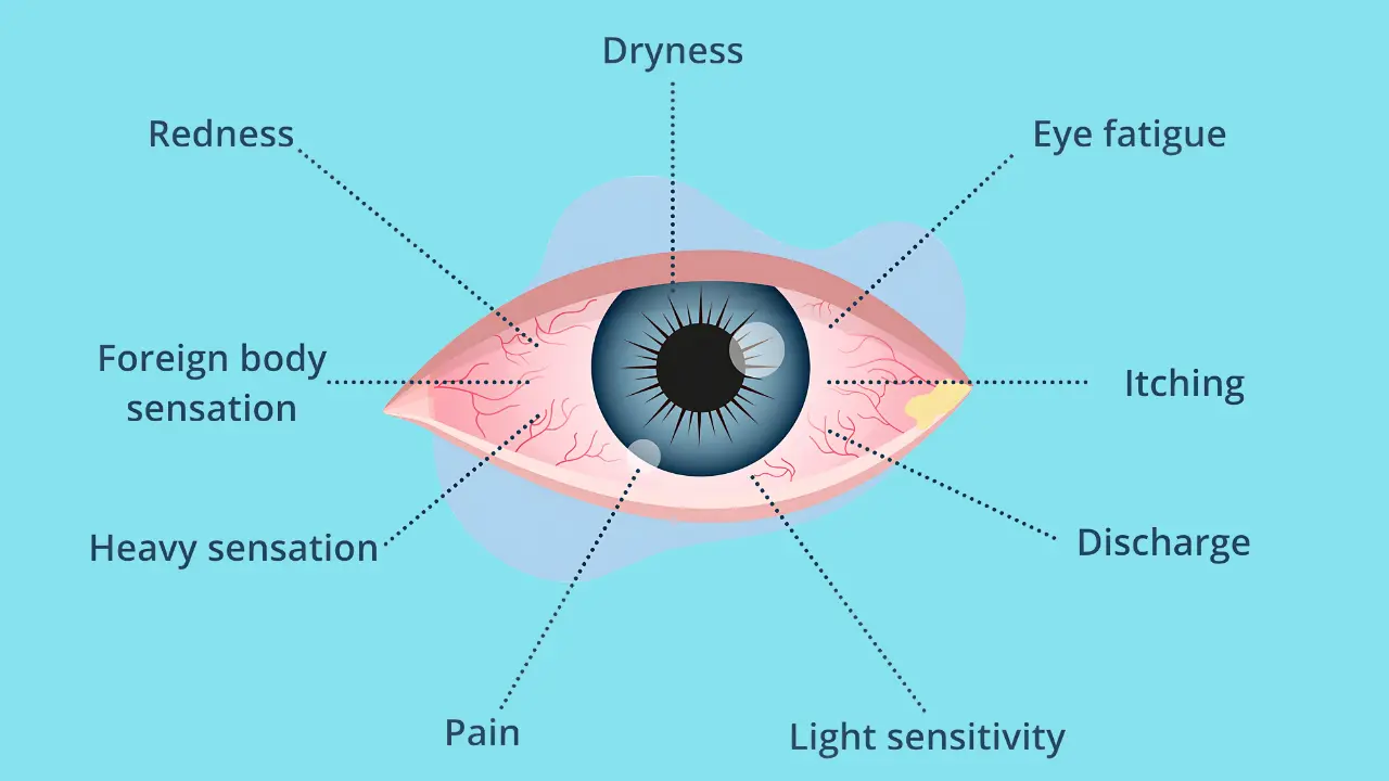 Dry Eyes With Contacts