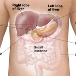 Proton Therapy Liver Cancer