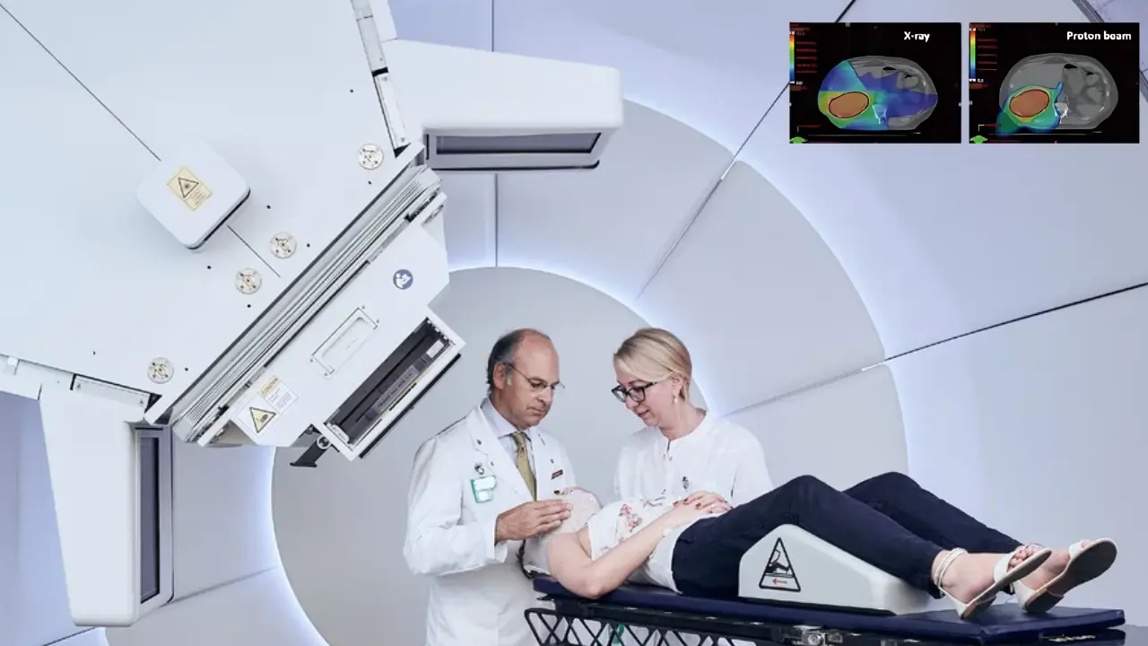 Proton Therapy Liver Cancer