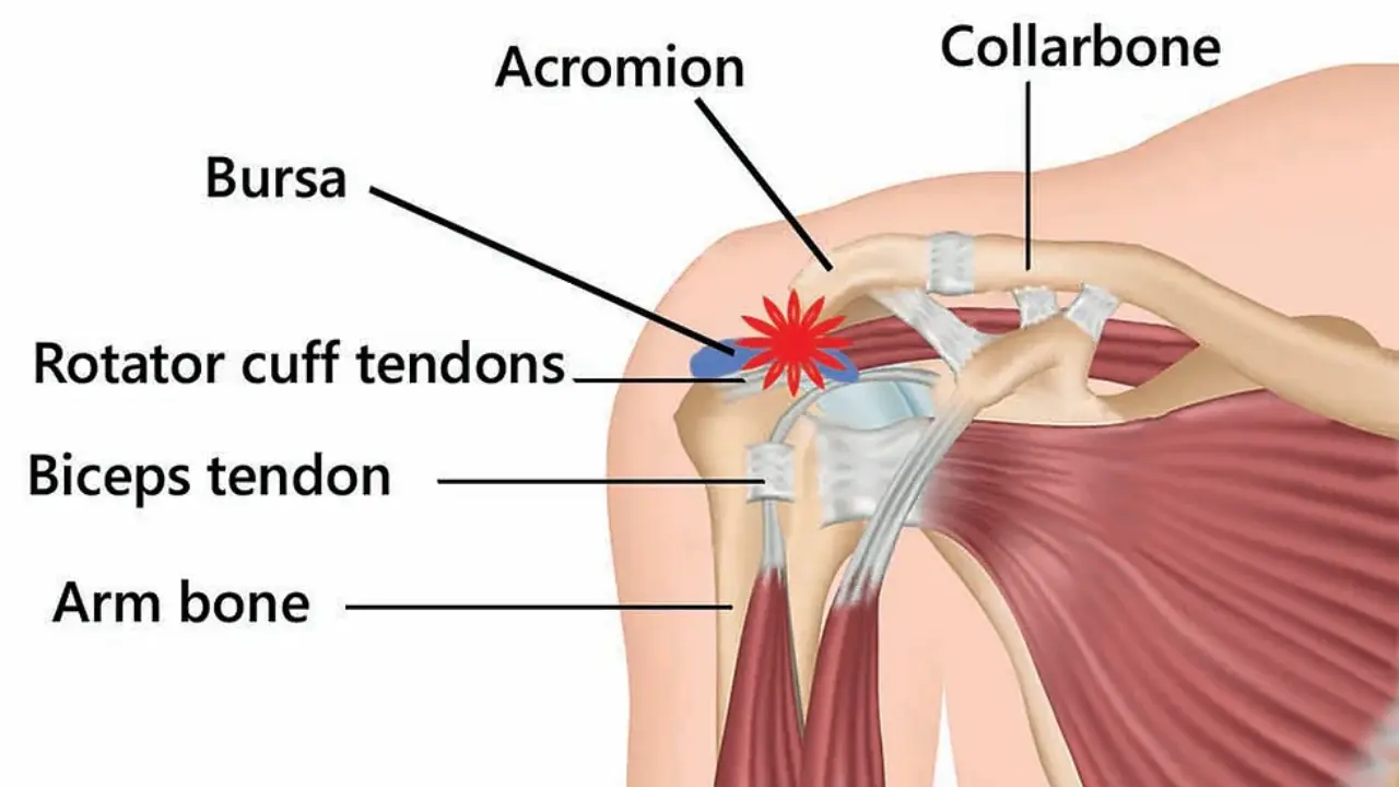 Shoulder Elbow Wrist Pain