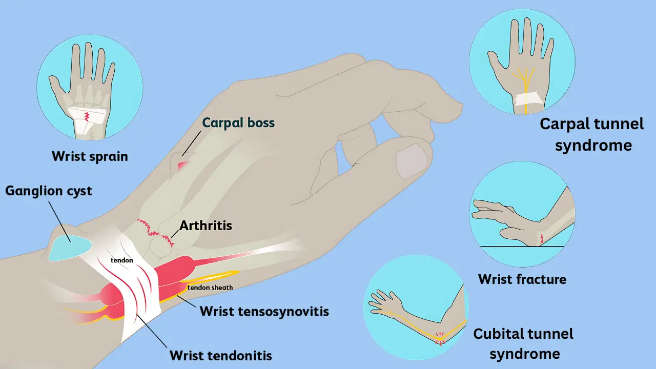 Shoulder Elbow Wrist Pain